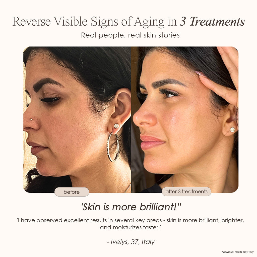 REVA | Instant Age Renewal Wand